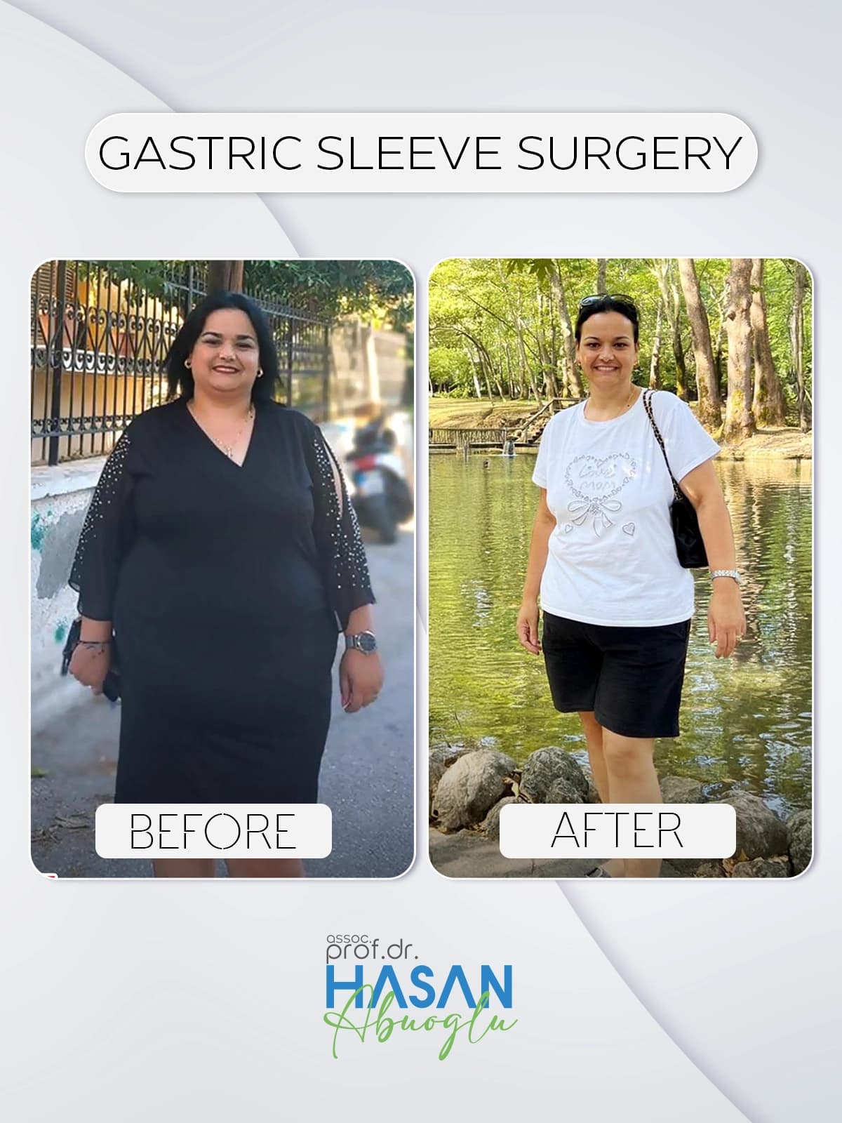 Obezite cerrahisi öncesi ve sonrası dönüşüm